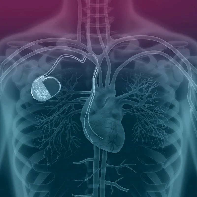 ICD افضل دكتور قلب في مصر