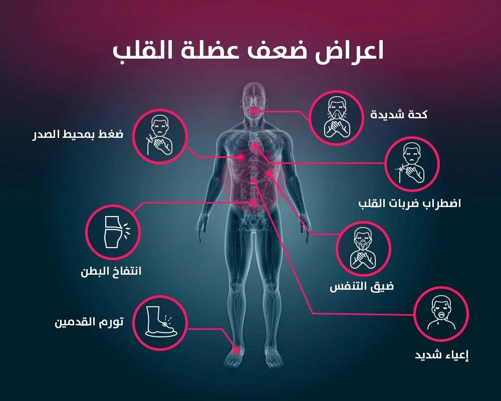 اعراض-ضعف-عضلة-القلب اعراض ضعف عضلة القلب