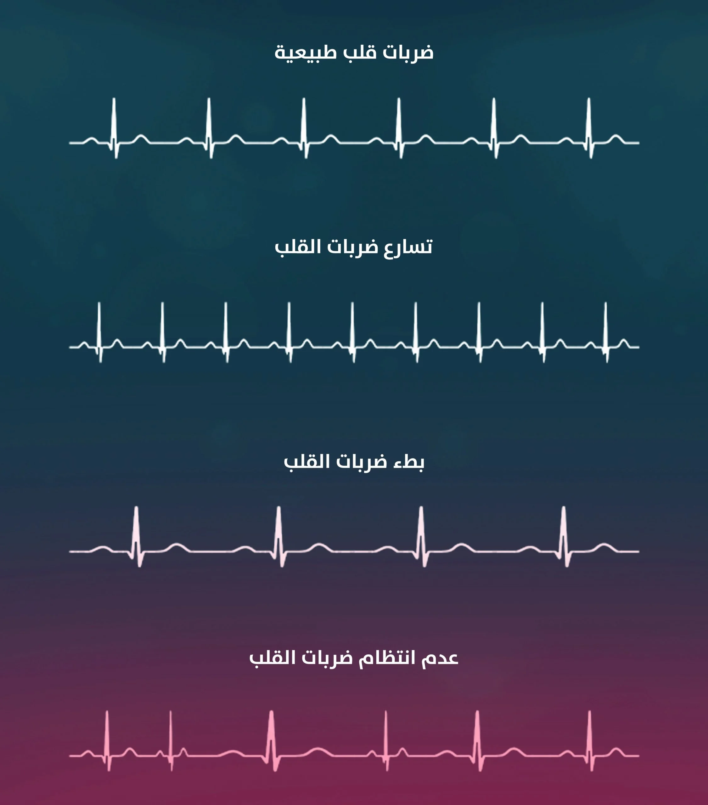 علاج عدم انتظام ضربات القلب