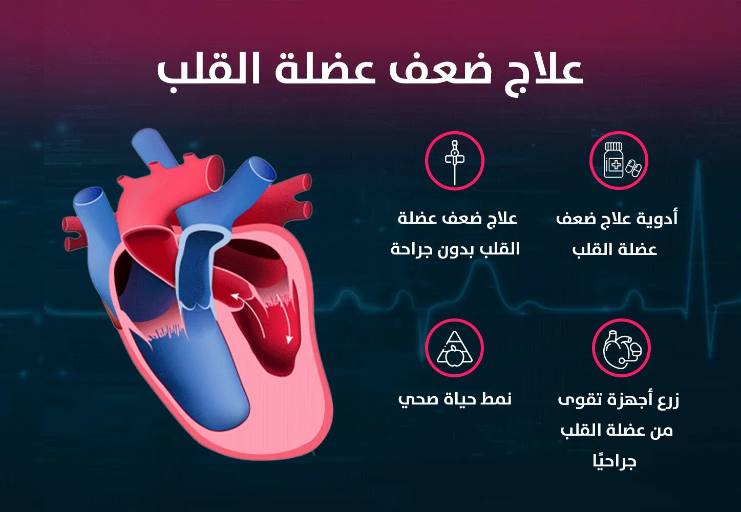 علاج-ضعف-عضلة-القلب اعراض ضعف عضلة القلب