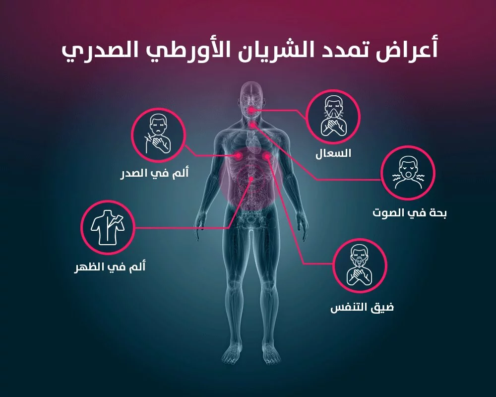 دعامة الشريان الأورطي دعامة الشريان الأورطي