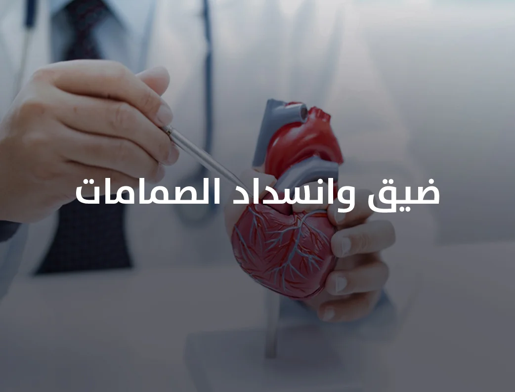 افضل دكتور قلب في مصر
